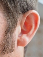 Hörsturz – Diagnose