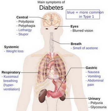 Zuckerkrankheit - Diabetes Typ 2