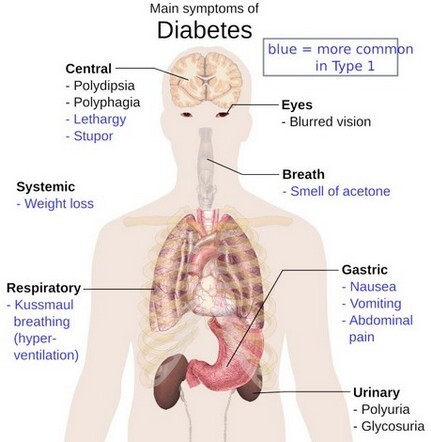 Diabetisches Fußsyndrom – Symptome