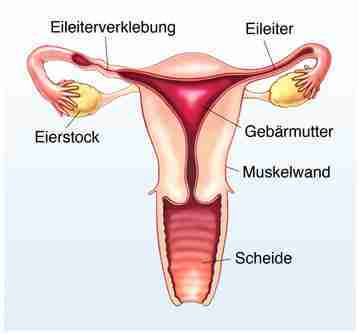 Frauenkrankheit - Endometriose