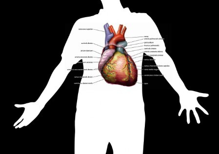Unterschied zwischen den Geschlechtern- Herzinfarkt