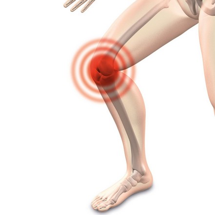 Kniegelenksarthrose – Symptome