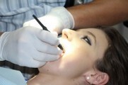 Gewürznelke gegen Zahnfleischentzündung